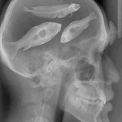Fish on the brain