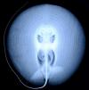 Stingray X-Ray