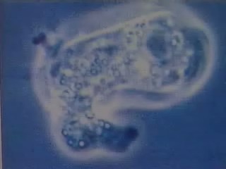 Killer Amoeba in Tropical FRESH WATER see BLOG for warning & Info