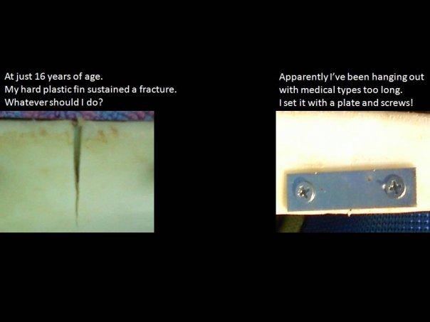 Fin Fracture