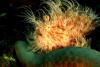 hairy frogfish